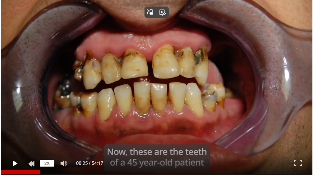 Bad oral health thumbnail